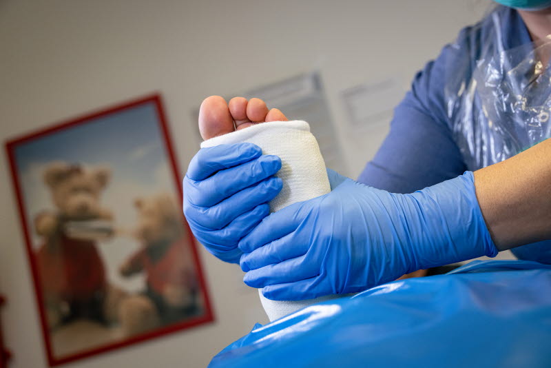 En gipstekniker på en närakut gipsar en patients fot. Foto: Yanan Li